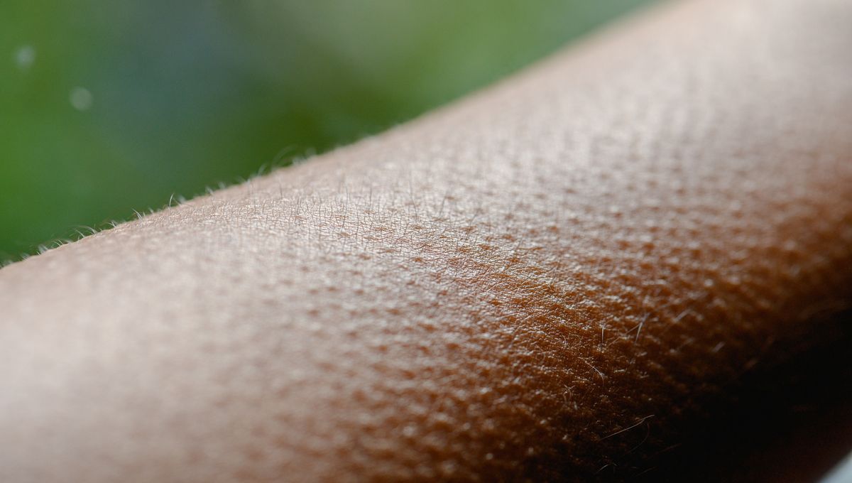 Làn da và phản ứng nổi da gà