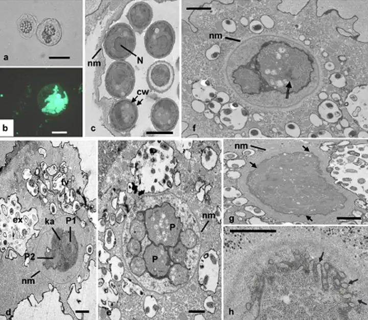 Sinh vật thực nhân có đặc điểm giống virus