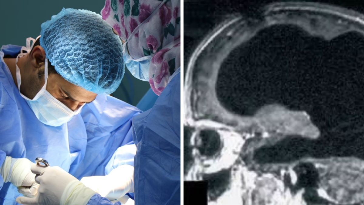 Bí ẩn về người đàn ông mất 90% não, nhưng vẫn có thể sống một cuộc sống bình thường- Ảnh 3. Khả năng tái cấu trúc mạng lưới thần kinh trong não