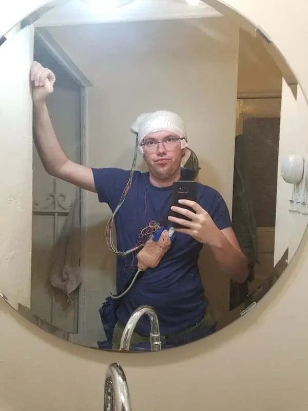 Jody Smith trải qua phẫu thuật não