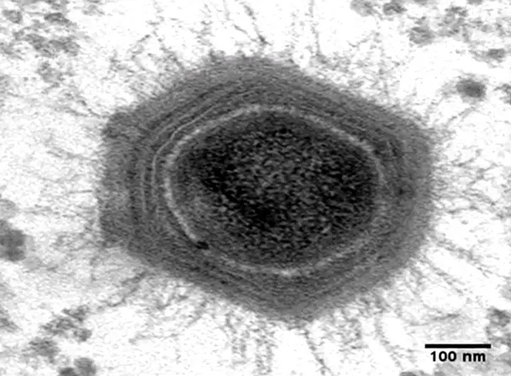 Virus khổng lồ Mimivirus dưới kính hiển vi