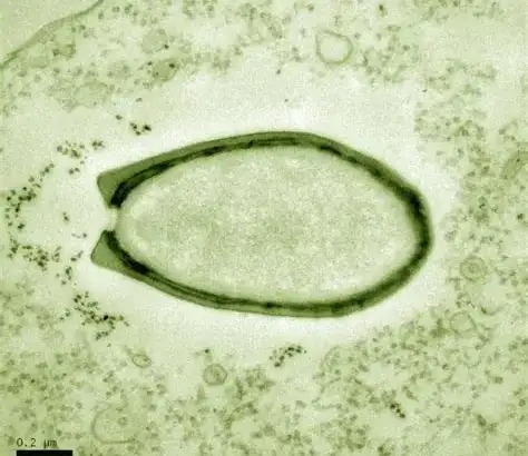 Virus Pandoravirus kích thước lớn